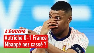 Nez cassé pour Mbappé  Grosse inquiétude pour la suite de l’Euro 2024 [upl. by Wehtta]