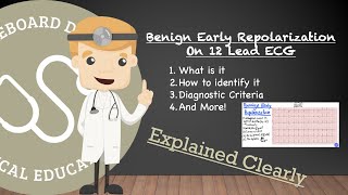 Benign Early Repolarization On Actual 12 Lead ECG  Identifying Diagnostic Criteria And More [upl. by Enilarak]