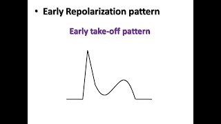 ECG course STEMI or Early Repolarization Pattern Dr Sherif Altoukhy [upl. by Anuala]