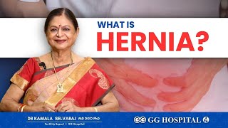 Reasons for Hernia  Easy Solutions  Dr Kamala Selvaraj  GG Hospital  hernia gg gghospital [upl. by Essined530]