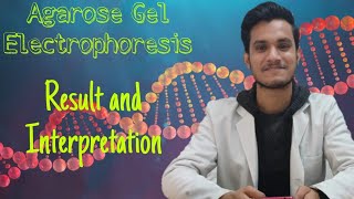 Agarose Gel Electrophoresis  Result amp Interpretation  DNA biotechnology technique lifescience [upl. by Gloriana]