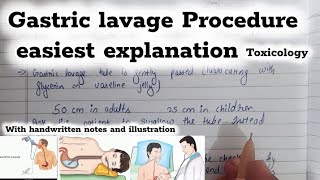 Gastric lavage Procedure stomach wash General toxicology fmt toxicology [upl. by Ymarej]