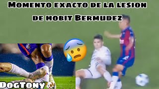 Lesión de quotHobbitquot Bermúdez hoy en el partido Atlante vs Dorados momento exacto [upl. by Neva]