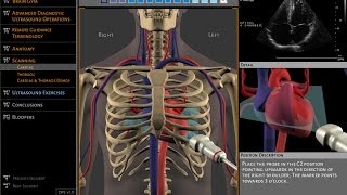 Basics of ultrasound machine [upl. by Sivla]