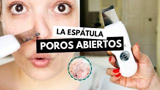 Pruebo la ESPÁTULA ULTRASÓNICA contra POROS ABIERTOS y sebo facial  Pretty and Olé [upl. by Anaxor]