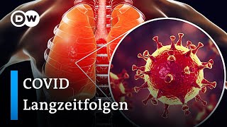 Long Covid Wenn Coronavirus Symptome nicht verschwinden  DW Nachrichten [upl. by Wojcik]