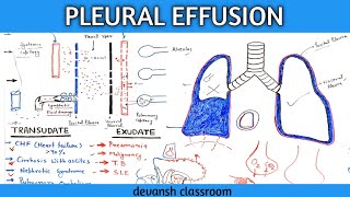 pleural effusion pathophysiology in Hindi part 1 [upl. by Yadrahs]