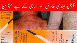 clobevate cream for whitening  clobevate cream uses in urdu  clobevate cream  clobetasol cream [upl. by Tsan]