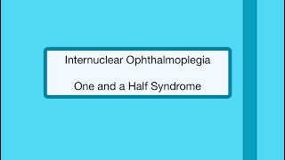 Internuclear Ophthalmoplegia  One and a Half Syndrome 👁 [upl. by Arlie]