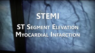 NHRMC Heart Center  STEMI Training Video [upl. by Morie321]