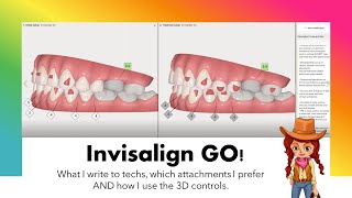 Invisalign GO ClinCheck amp case analysis [upl. by Celestina]