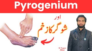 Pyrogenium  Diabetes Foot  Chronic Typhoid  Malaria  Understanding Urdu ampHindi  By Dr Tuqeer [upl. by Rellim]