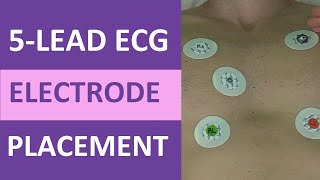 5 Lead ECG Placement of Electrodes EKG NCLEX amp Nursing Mnemonic [upl. by Ogilvy376]