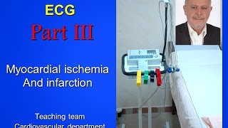 ECG part III [upl. by Letrice]