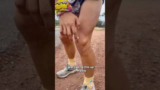 TEARING knee cartilage by running a week of marathons [upl. by Namhar]