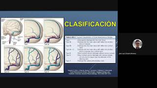 Fistulas arteriovenosas durales [upl. by Kenzi]