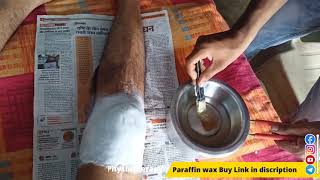 what is a paraffin bath physical therapy paraffin wax Treatment at home physiotherapy wax benefits [upl. by Lizzy]