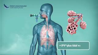 Percussionaire High Frequency Ventilation [upl. by Eelsnia]