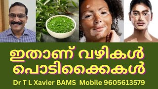 വെള്ളപാണ്ഡു  Vitiligo Relief Discover Ayurvedic Home Remedies [upl. by Emelin]