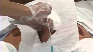 Foley Catheter Skills Demonstration 2 of 3 [upl. by Ivie]