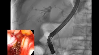 FLORIDA LIVE AUGUST 2224 2024 EDUCATIONAL VIDEO ROLE OF SLIM DUODENOSCOPES IN PRACTICE OF ERCP [upl. by Homerus]