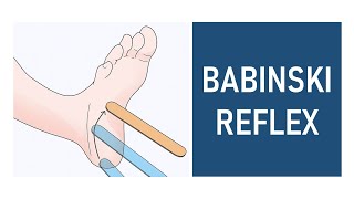 Babinski Reflex Plantar Reflex [upl. by Gilbertine342]