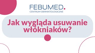 Jak wygląda usuwanie włókniaków [upl. by Gnex]