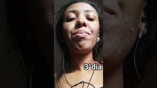 Resultado do peeling de algas ou mar morto em pele negra cuidadoscomapele skincare [upl. by Shulins]