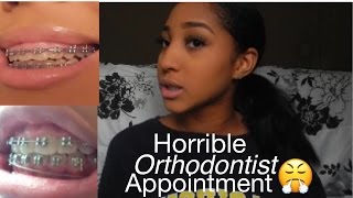 My HORRIBLE orthodontist appointment STORYTIME Braces update [upl. by Dadinirt]