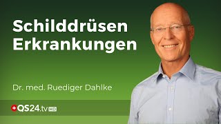 Wenn die Schilddrüse aus der Reihe tanzt  Dr med Ruediger Dahlke  QS24 Gesundheitsfernsehen [upl. by Montgomery]