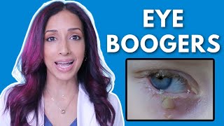 Is Morning Eye Discharge Normal Eye Doctor Explains [upl. by Grossman]