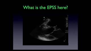 Test Your Ultrasonography Skills  must see [upl. by Isabel]