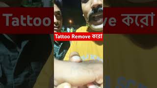 Tattoo Remove করো । [upl. by Crystal]