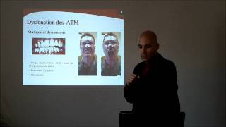 9 Lorthèse buccale active kinepod conférencewmv [upl. by Nylirrehs]