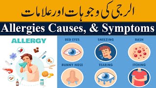 What is Allergy  Causes Signs and Symptoms Must Watch [upl. by Levitan]