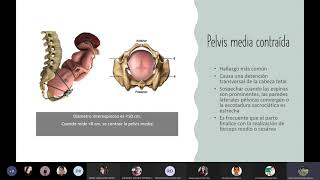 Clase 3 Distocia de pelvis [upl. by Biggs]