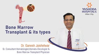 Bone Marrow Transplant amp Its Types Explained  Yashoda Hospitals  Yashoda Hospitals Hyderabad [upl. by Enaenaj]