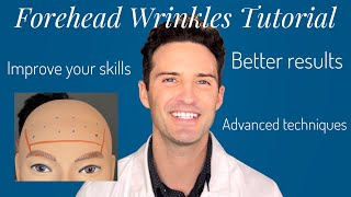 Forehead Wrinkles Treatment Tutorial beginner and advanced [upl. by Adner]