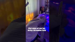 Dermaplane PRO  Best Ever Skin 📍 Clarendon Hills IL [upl. by Justicz]