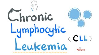 Chronic Lymphocytic Leukemia CLL  Etiology Risk Factors Symptoms Signs Diagnosis Treatment [upl. by Yendirb]