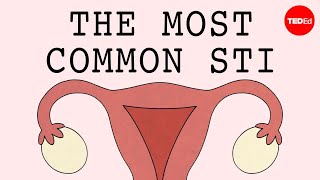 The most common STI in the world  Emma Bryce [upl. by Hervey443]