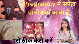 white discharge in pregnancyक्या pregnancy में white discharge नार्मल है।pregnancydrromagupta [upl. by Priebe]