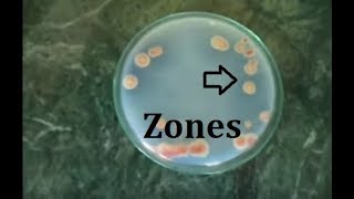 How to isolate phosphate solubilizing bacteria [upl. by Ailehs]