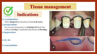 Tissue Management Gingival Retraction Indications amp Requirements دواعي ابعاد اللثة ومتطلباتها [upl. by Nahpos]