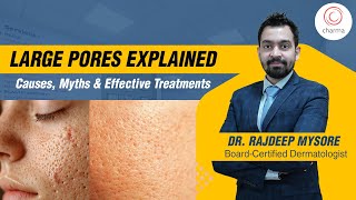 Effective Treatments for Large Pores What You Need to Know  Dr Rajdeep Mysore  Charma Clinic [upl. by Bram686]