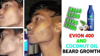 Evion 400 for beard growthevion 400 and coconut oil for beard growthhow to use evion 400 for beard [upl. by Sirapal]