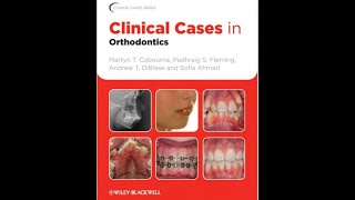 Clinical Cases in Orthodontics  chapter 3  case 11 شرح لواحد من كتب تقويم الاسنان باللغه العربيه [upl. by Leffert]