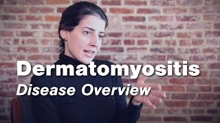 Dermatomyositis  Disease Overview  Johns Hopkins [upl. by Rhoads]