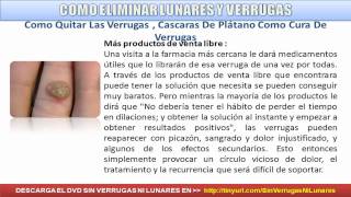 COMO ELIMINAR VERRUGAS  SIN VERRUGAS NI LUNARES [upl. by Bryce866]