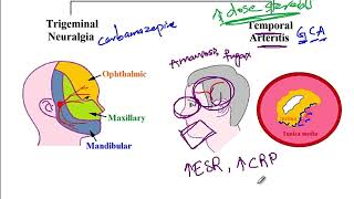 USMLE ACE Video 212 Differential Diagnosis of Jaw Pain Trigeminal Neuralgia vs Temporal Arteritis [upl. by Gaulin676]